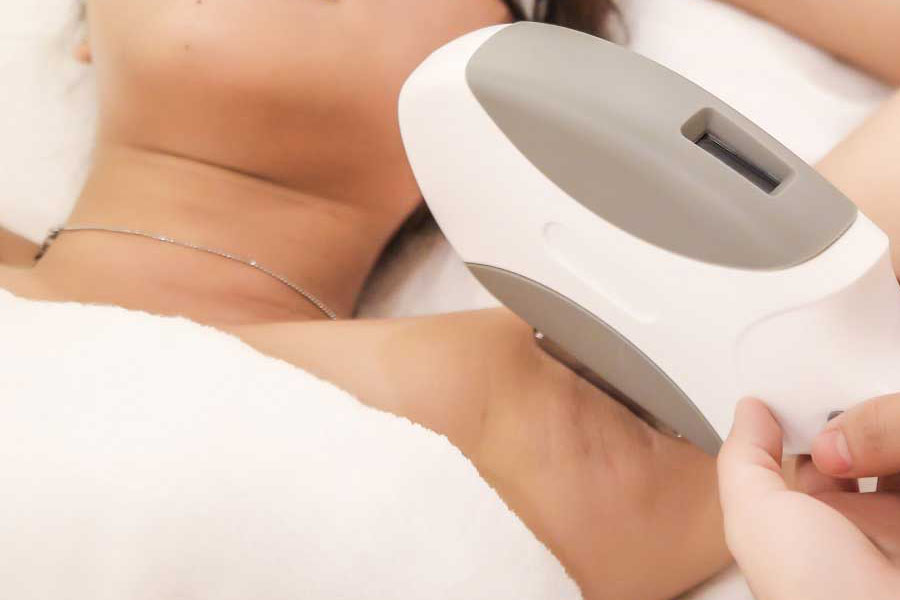 Triệt lông OPT là gì? Ưu điểm của triệt lông bằng công nghệ OPT