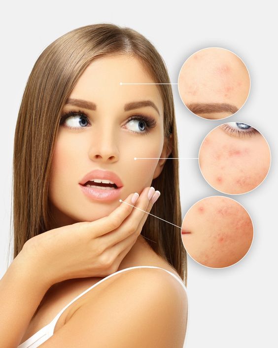 14 loại kem dưỡng ẩm tốt nhất cho da dầu năm 2024 14 loai kem duong am tot nhat cho da dau nam 2024 1