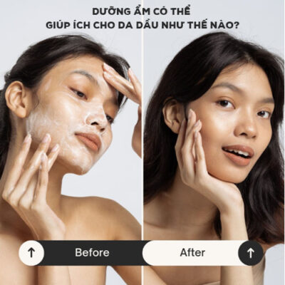 Dưỡng ẩm có thể giúp ích cho da dầu như thế nào?