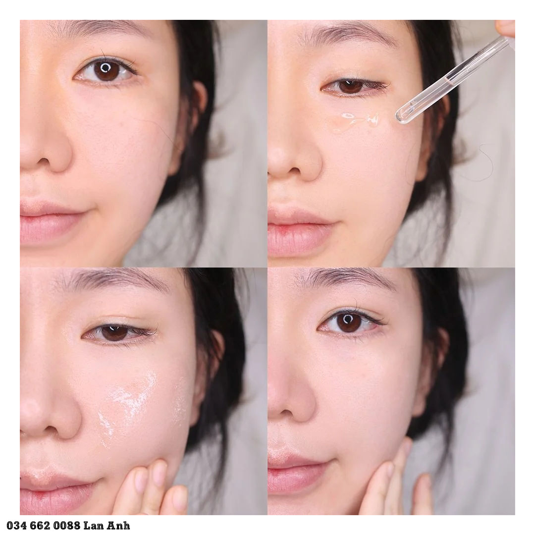 Serum La Roche-Posay Giúp Phục Hồi Da 30ml Serum La Roche-Posay Giúp Tái Tạo & Phục Hồi Da 30ml Hyalu B5 Serum